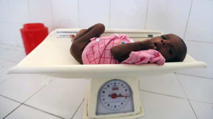 FILE PHOTO: An internally displaced Somali child is screened for malnutrition before receiving treatment inside a ward dedicated for diarrhoea patients at the Banadir hospital in Mogadishu