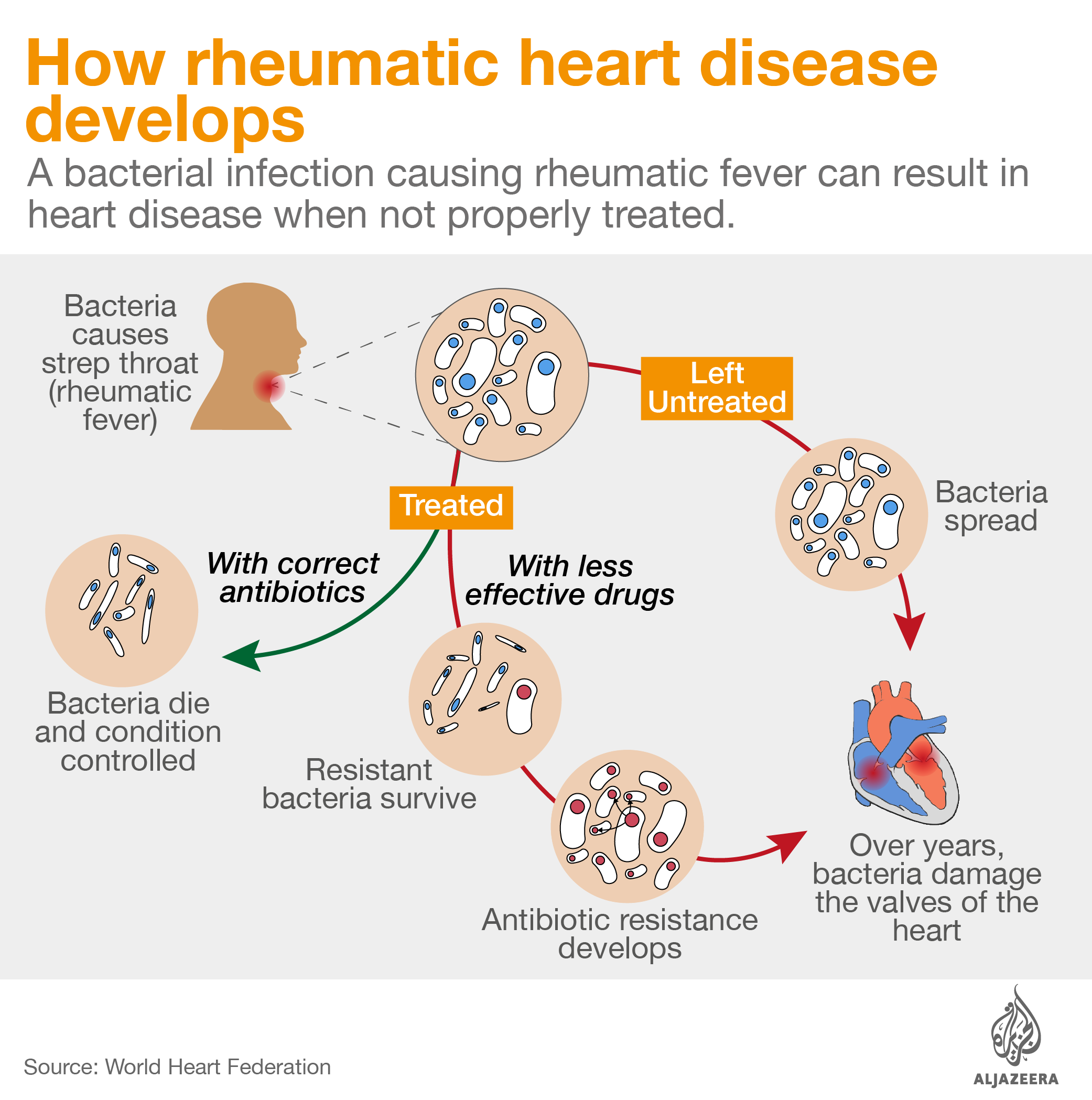 how rheumatic heart disease develops