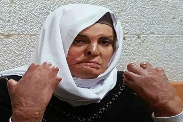 Israa Jaabis, Palestinian female prisoner